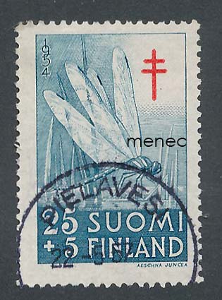 Tuberkuloosi 1954, 25+5, loisto 